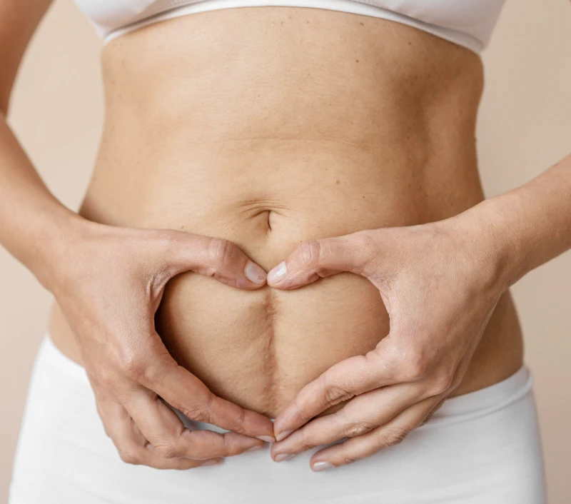A mother's hands forming a heart shape over her postpartum belly